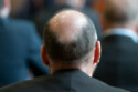 A half-bald man