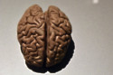 A teenager has an astonshing memory that means she can vividly remember moments in her life