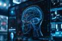 A large head can stave off dementia