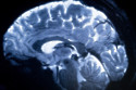 Brain during MRI exam simulation
