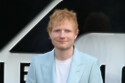 Ed Sheeran has been battling shingles
