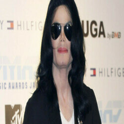 Michael Jackson suffered from the skin disorder vitiligo