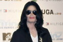 Michael Jackson suffered from the skin disorder vitiligo