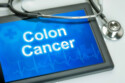 Shutting down a protein inside a cell could slow colorectal cancer