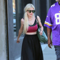 Tori Spelling claimed her dog chewed a human toe